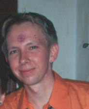 Warum hab ich was auf der Stirn?